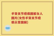 手背关节疤痕图解女人图片(女性手背关节疤痕示意图解)