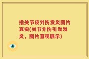 指关节皮外伤发炎图片真实(关节外伤引发发炎，图片直观展示)