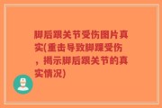 脚后跟关节受伤图片真实(重击导致脚踝受伤，揭示脚后跟关节的真实情况)