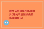踝关节肌腱损伤影像图片(踝关节肌腱损伤的影像图展示)