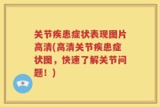 关节疾患症状表现图片高清(高清关节疾患症状图，快速了解关节问题！)