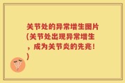 关节处的异常增生图片(关节处出现异常增生，成为关节炎的先兆！)