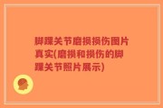 脚踝关节磨损损伤图片真实(磨损和损伤的脚踝关节照片展示)
