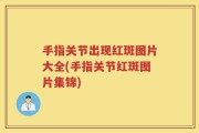 手指关节出现红斑图片大全(手指关节红斑图片集锦)