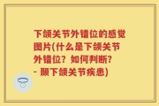 下颌关节外错位的感觉图片(什么是下颌关节外错位？如何判断？ - 颞下颌关节疾患)