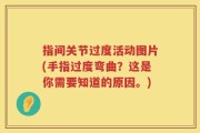 指间关节过度活动图片(手指过度弯曲？这是你需要知道的原因。)