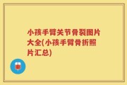 小孩手臂关节骨裂图片大全(小孩手臂骨折照片汇总)