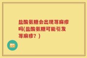 盐酸氨糖会出现荨麻疹吗(盐酸氨糖可能引发荨麻疹？)