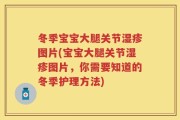 冬季宝宝大腿关节湿疹图片(宝宝大腿关节湿疹图片，你需要知道的冬季护理方法)