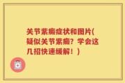 关节紫癜症状和图片(疑似关节紫癜？学会这几招快速缓解！)