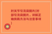 肘关节引流袋图片(肘部引流袋图片，详解正确佩戴方法与注意事项)