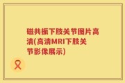 磁共振下肢关节图片高清(高清MRI下肢关节影像展示)