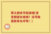 婴儿髋关节起痘痘(宝宝髋部长痘痘？这可能是股骨头坏死！)