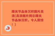 踝关节晶体沉积图片高清(高清图片揭示踝关节晶体沉积，令人震惊！)