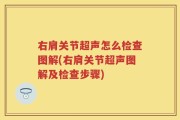 右肩关节超声怎么检查图解(右肩关节超声图解及检查步骤)