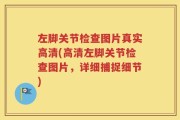 左脚关节检查图片真实高清(高清左脚关节检查图片，详细捕捉细节)