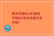 胯关节侧位x片(髋关节侧位X光片检查方法介绍)