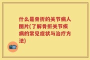 什么是骨折的关节病人图片(了解骨折关节疾病的常见症状与治疗方法)
