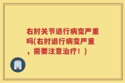 右肘关节退行病变严重吗(右肘退行病变严重，需要注意治疗！)