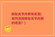 脚趾关节内侧有老茧(如何消除脚趾关节内侧的老茧？)