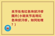 关节处有红色块状汗疹图片(小腿关节出现红色块状汗疹，如何处理？)