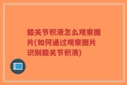 膝关节积液怎么观察图片(如何通过观察图片识别膝关节积液)