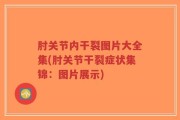肘关节内干裂图片大全集(肘关节干裂症状集锦：图片展示)