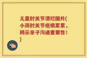 儿童肘关节溃烂图片(小孩肘关节疮痕累累，揭示亲子沟通重要性！)