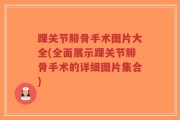 踝关节腓骨手术图片大全(全面展示踝关节腓骨手术的详细图片集合)