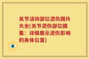 关节活动部位烫伤图片大全(关节烫伤部位图集：详细展示烫伤影响的身体位置)