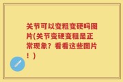 关节可以变粗变硬吗图片(关节变硬变粗是正常现象？看看这些图片！)