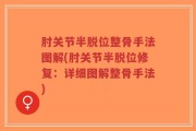 肘关节半脱位整骨手法图解(肘关节半脱位修复：详细图解整骨手法)