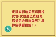 皮肌炎影响关节吗图片女性(女性患上皮肌炎后是否会影响关节？具体症状看图解！)