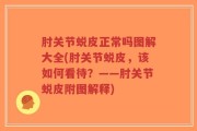 肘关节蜕皮正常吗图解大全(肘关节蜕皮，该如何看待？——肘关节蜕皮附图解释)