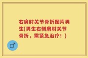 右肩肘关节骨折图片男生(男生右侧肩肘关节骨折，需紧急治疗！)