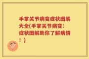 手掌关节病变症状图解大全(手掌关节病变：症状图解助你了解病情！)