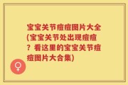 宝宝关节痘痘图片大全(宝宝关节处出现痘痘？看这里的宝宝关节痘痘图片大合集)