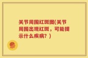关节周围红斑图(关节周围出现红斑，可能提示什么疾病？)