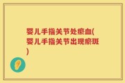 婴儿手指关节处瘀血(婴儿手指关节出现瘀斑)