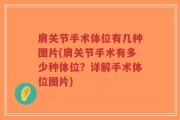肩关节手术体位有几种图片(肩关节手术有多少种体位？详解手术体位图片)
