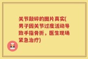 关节敲碎的图片真实(男子因关节过度活动导致手指骨折，医生现场紧急治疗)