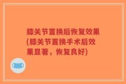 膝关节置换后恢复效果(膝关节置换手术后效果显著，恢复良好)