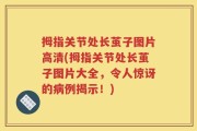 拇指关节处长茧子图片高清(拇指关节处长茧子图片大全，令人惊讶的病例揭示！)