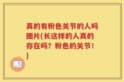 真的有粉色关节的人吗图片(长这样的人真的存在吗？粉色的关节！)