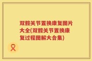 双髋关节置换康复图片大全(双髋关节置换康复过程图解大合集)