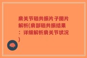 肩关节磁共振片子图片解析(肩部磁共振结果：详细解析肩关节状况)