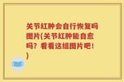 关节红肿会自行恢复吗图片(关节红肿能自愈吗？看看这组图片吧！)