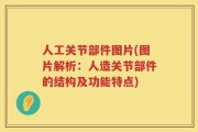 人工关节部件图片(图片解析：人造关节部件的结构及功能特点)