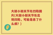 大腿小腿关节处凹陷图片(大腿小腿关节处出现凹陷，可能是患了什么病？)