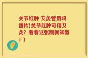关节红肿 艾灸管用吗图片(关节红肿可用艾灸？看看这张图就知道！)